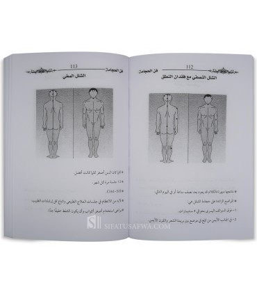 The Art of Cupping Therapy (Hijamah) - with photos - Dr Amr Elrayes  فن الحجامة - د. عمرو الريس