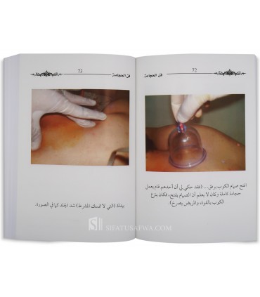 The Art of Cupping Therapy (Hijamah) - with photos - Dr Amr Elrayes  فن الحجامة - د. عمرو الريس